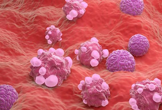 Lesiones en el Cuello Uterino